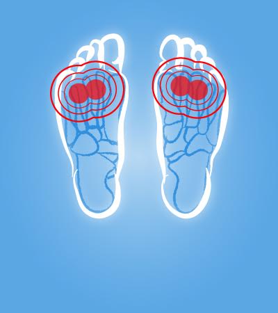 Metatarsalgie - Orthopedisch Schoenmakerij